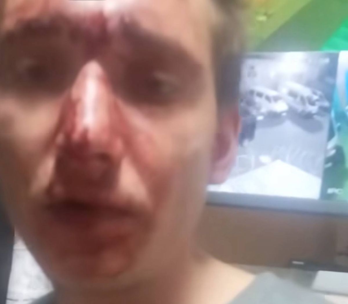 У Рівненському ТЦК прокоментували відео мобілізованого з розбитим обличчям 