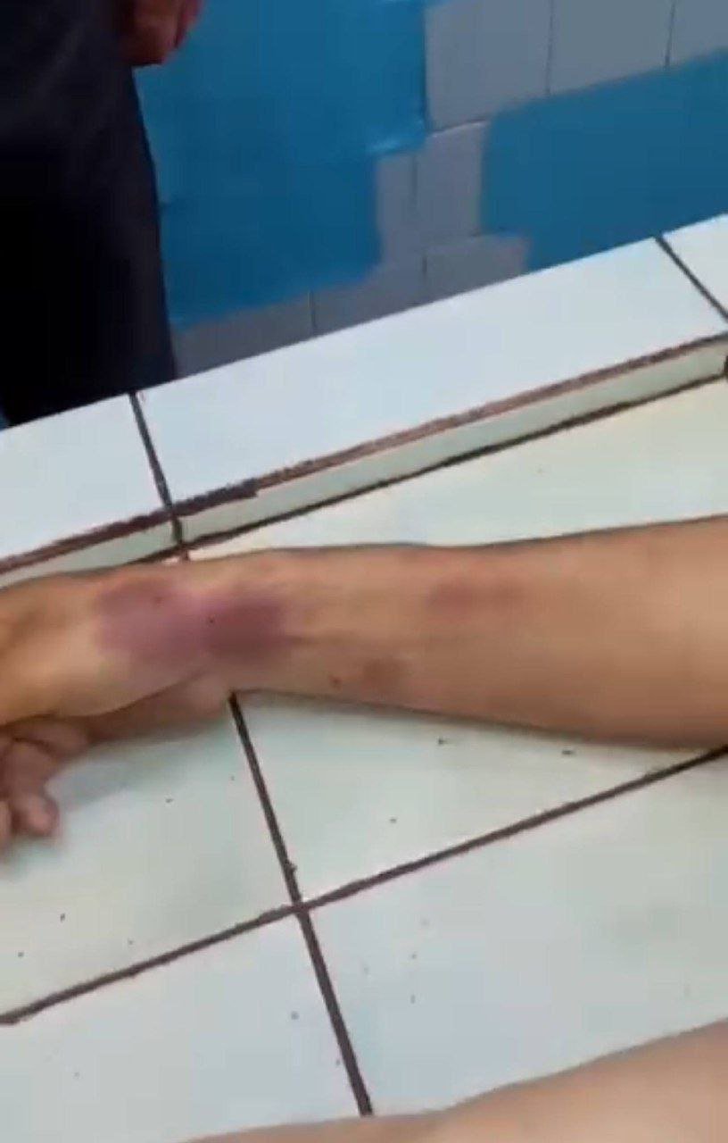 На тілі померлого після мобілізації мешканця Рівненщини виявили численні гематоми