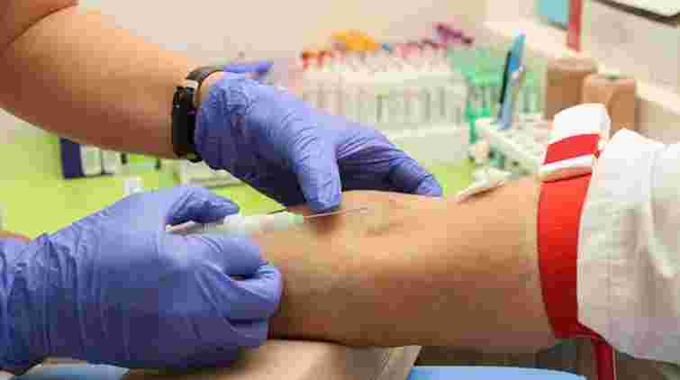 Жіночий check-up: які обстеження і в якому віці треба пройти обовʼязково, щоб бути здоровою