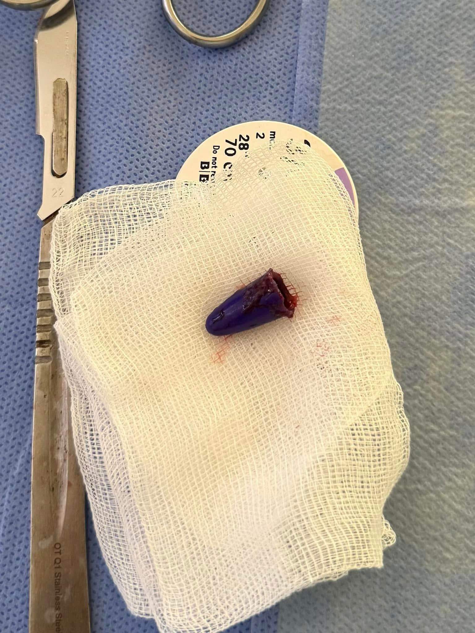 Маленький ковпачок наробив великої біди