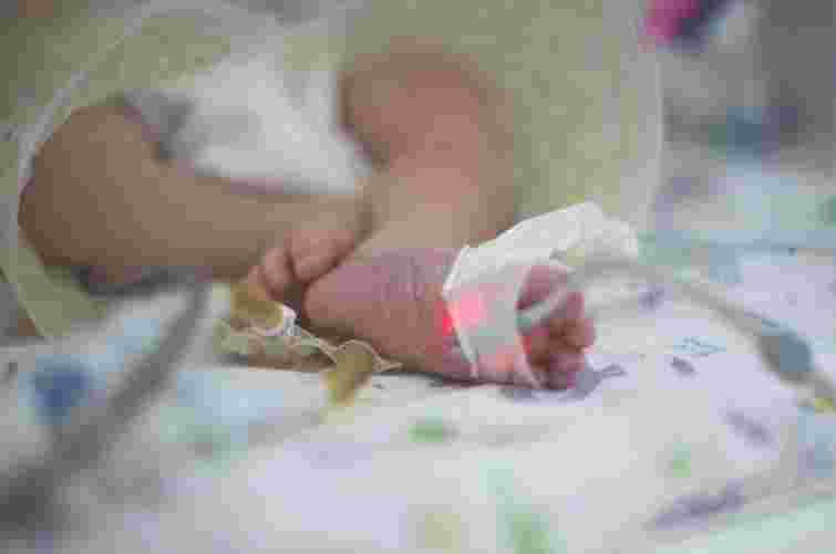 Львівські лікарі врятували 28-денну дівчинку з ковідом і синдром Лайєлла 