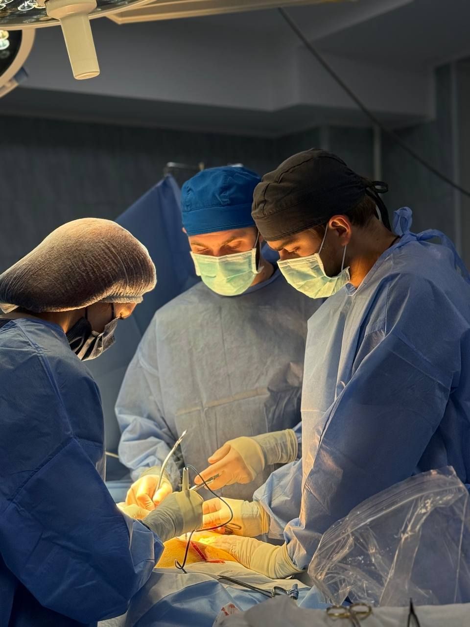 Команда рівненських лікарів провела забір двох нирок у посмертної донорки (фото лікарні)