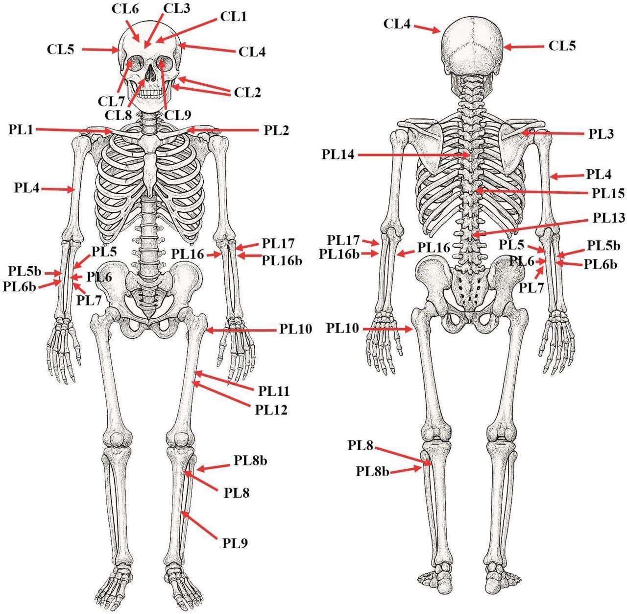 Дослідники зазначили стрілками усі пошкодження кісток