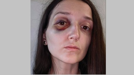 У львівському трамваї підліток побив пасажирку, поліція почала розслідування