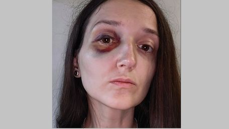 У львівському трамваї підліток побив пасажирку, поліція почала розслідування