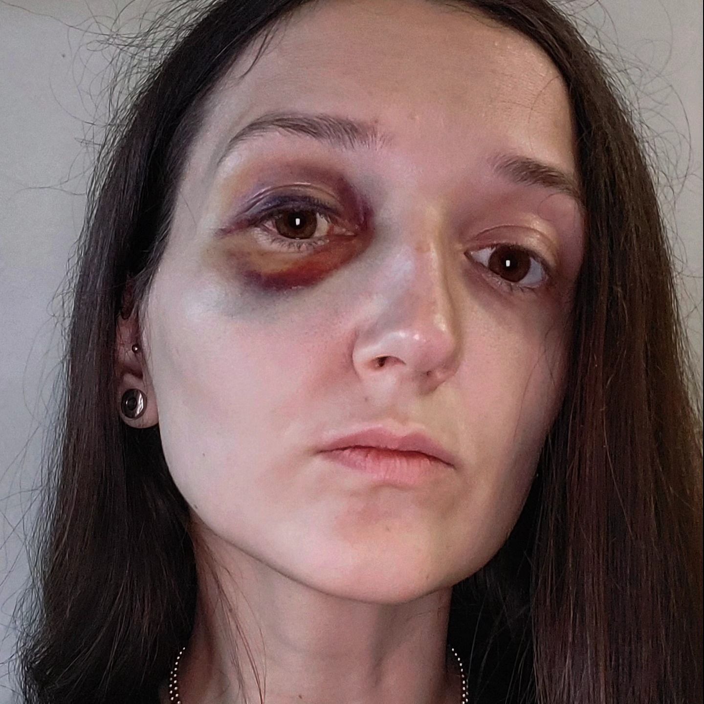 Вікторія Воловенко оприлюднила фото після побиття у трамваї