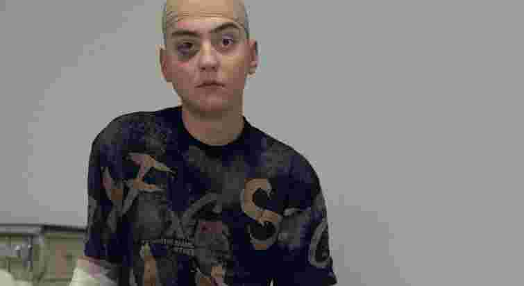 Нейрохірурги Львова успішно видалили рідкісну пухлину мозку 17-річному підлітку з Вінниці