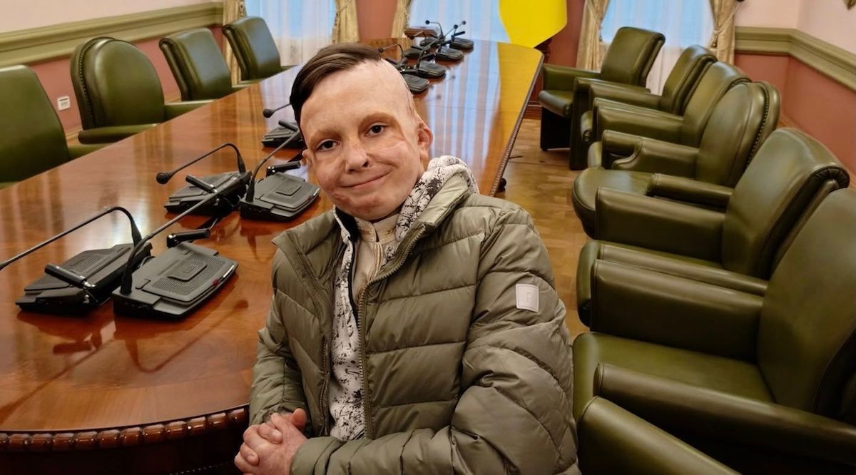 Президент нагородив львівського школяра, який пережив 35 операцій після російської атаки