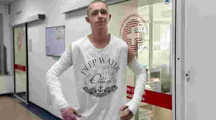 Львівські лікарі врятували 19-річного хлопця, що % тіла