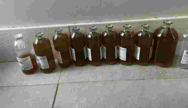 Лікарі викачали з ділянки біля серця буковинки майже 2,5 літра рідини