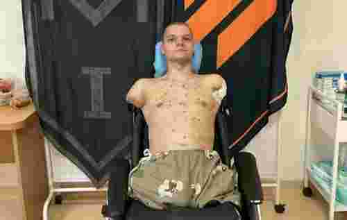 20-річний захисник без кінцівок не зміг отримати картку, «ПриватБанк» та голова НБУ відреагували