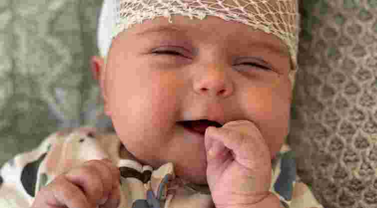 Нейрохірурги Львова врятували двомісячне немовля з Рівного з пухлиною мозку