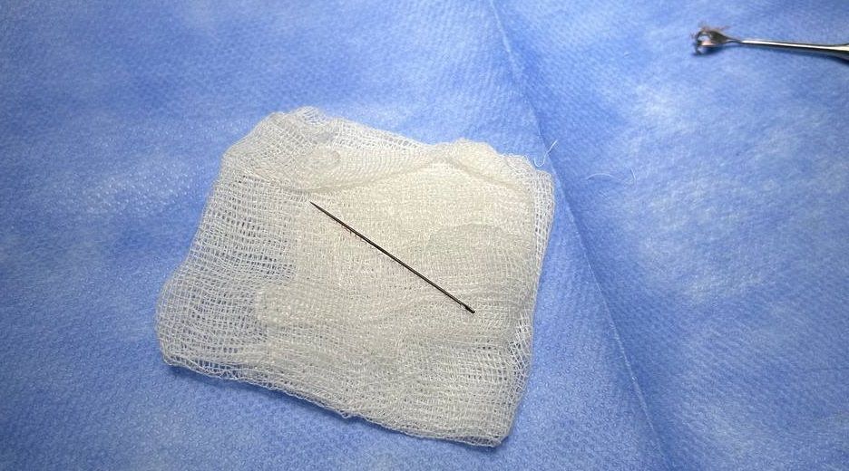 Дівчинка тиждень ходила з голкою і навіть про це не здогадувалася