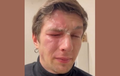 Львів'янка розпилила перцевий балончик в обличчя ветерану за зауваження про сміття