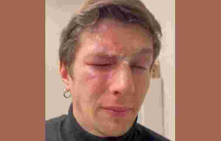 Львів'янка розпилила перцевий балончик в обличчя ветерану за зауваження про сміття