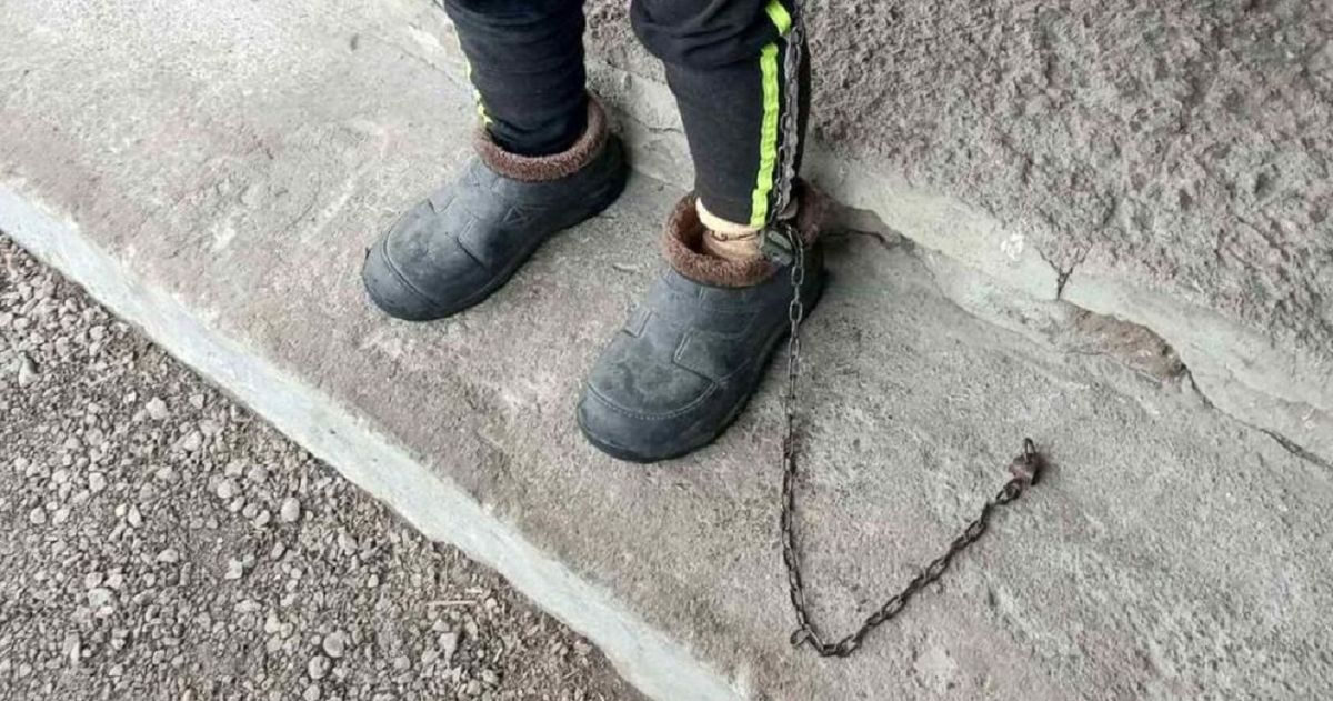 На Кіровоградщині опікунка тримала на ланцюгу 17-річну дівчину з інвалідністю