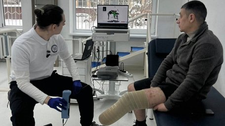 В Університетській лікарні ЛНМУ запрацювала найбільша в Європі  протезна майстерня