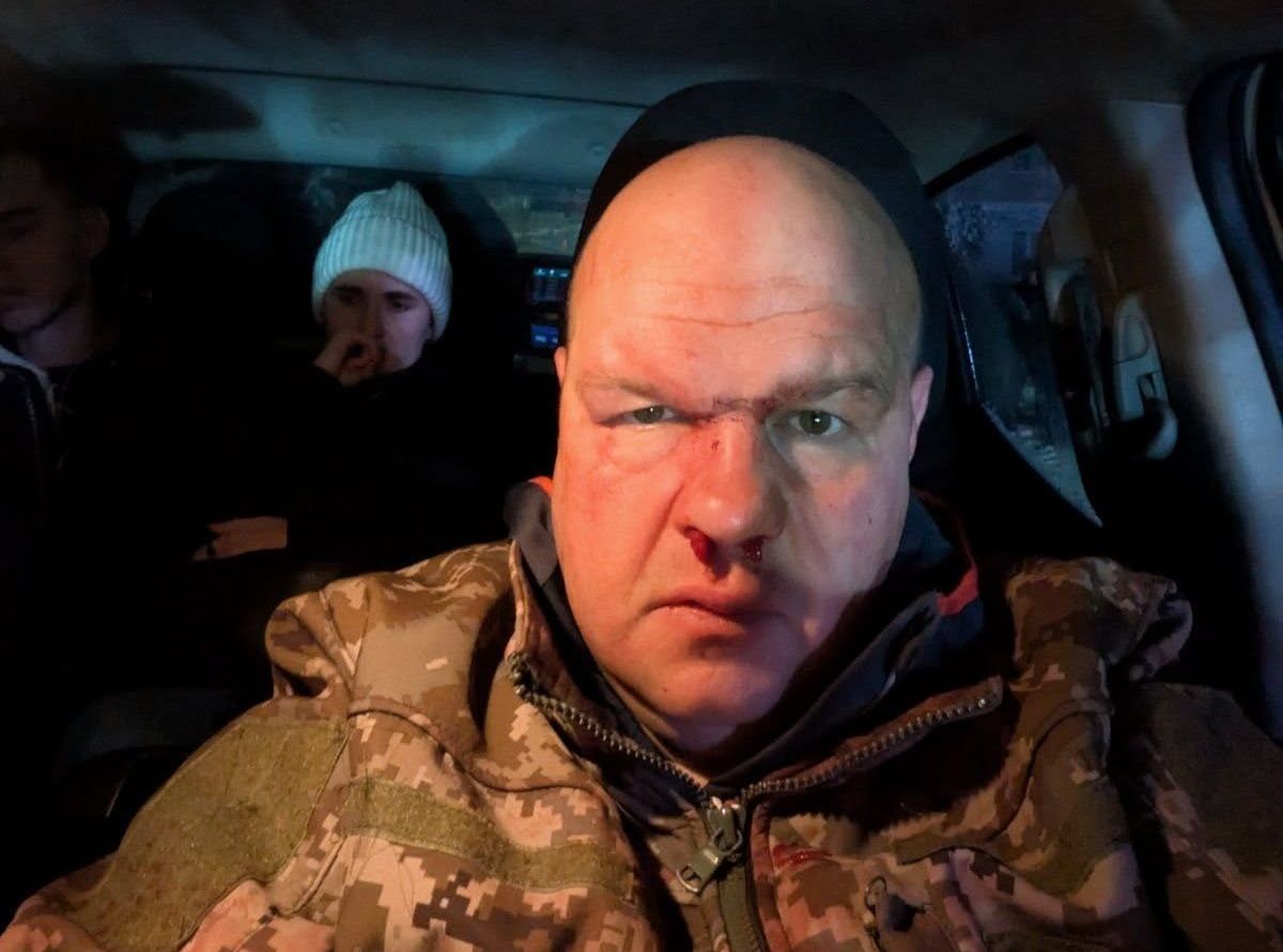 Поліція розслідує побиття військового після ДТП у Кременці 