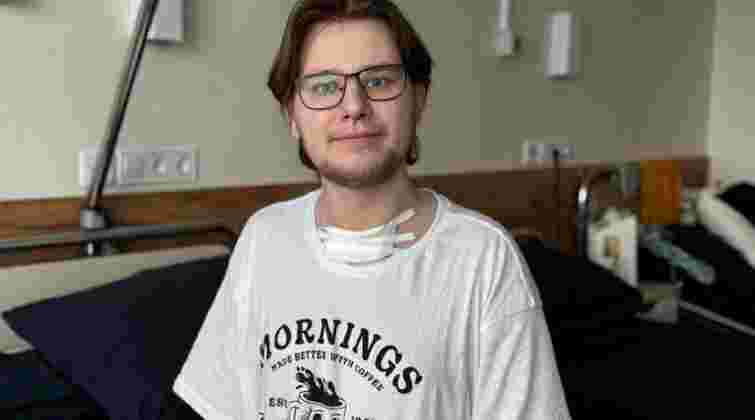 Через пізнє звернення по меддопомогу 22-річний студент опинився в реанімації на ШВЛ