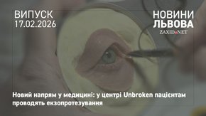 У центрі Unbroken показали, як проводять екзопротезування пацієнтів 
