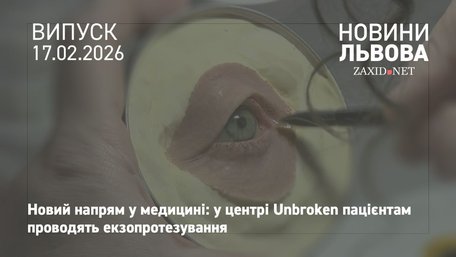 У центрі Unbroken показали, як проводять екзопротезування пацієнтів 