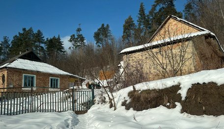 Жителька Тернопільщини запідозрила в себе сказ, який могла підхопити від лисиці і собаки