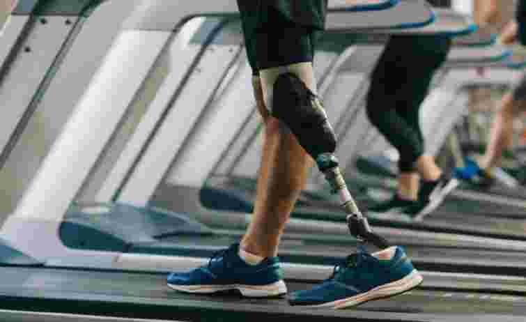 Львівська лікарня вперше через держзакупівлю замовила 50 біонічних протезів коліна на 30 млн грн