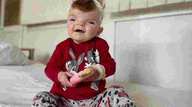 Нейрохірурги Львова заново сформували череп однорічній дівчинці з Рівненщини