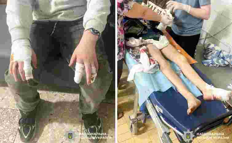 Собаки напали на двох малолітніх хлопців біля підприємства на Рівненщині