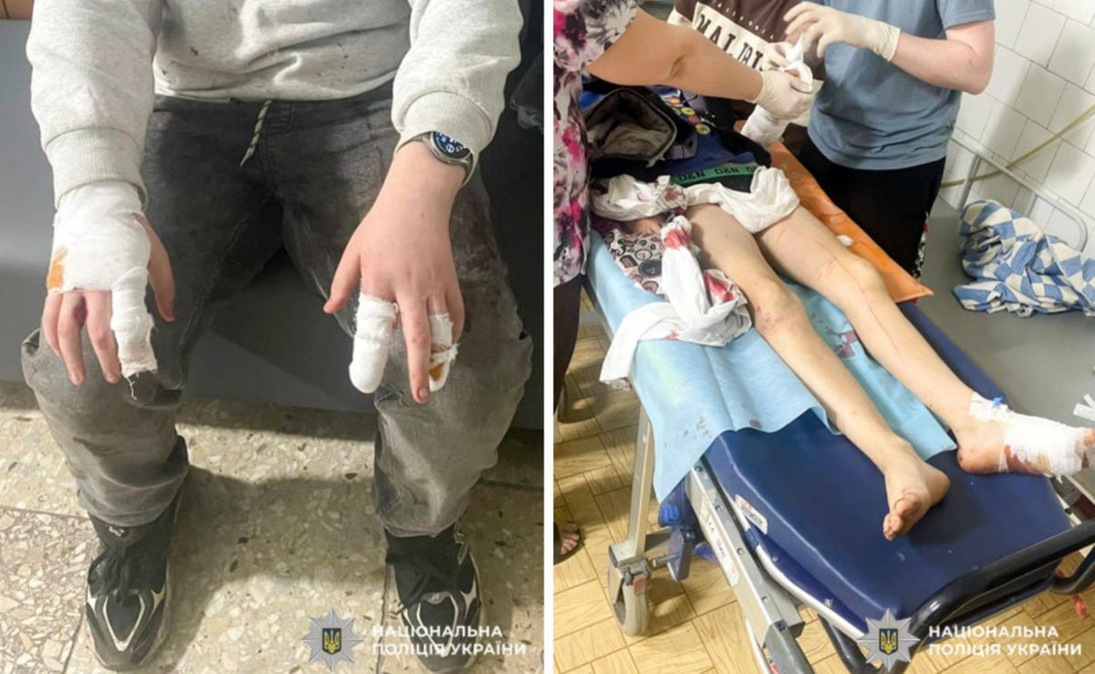 Собаки напали на двох малолітніх хлопців біля підприємства на Рівненщині