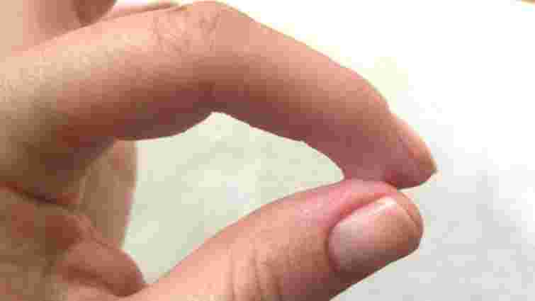 Вас більше не буде мучити це питання: як швидко видалити суперклей зі шкіри