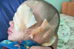 Мешканка Рівненщини уникла покарання за виколоте око дворічного сина