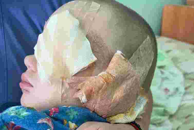 Мешканка Рівненщини уникла покарання за виколоте око дворічного сина