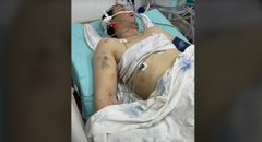 «Він вибіг з намету і почав битися головою об дерево»