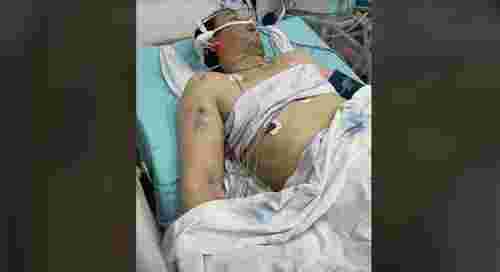 «Він вибіг з намету і почав битися головою об дерево»