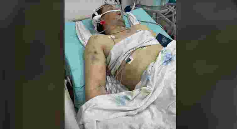 «Він вибіг з намету і почав битися головою об дерево»