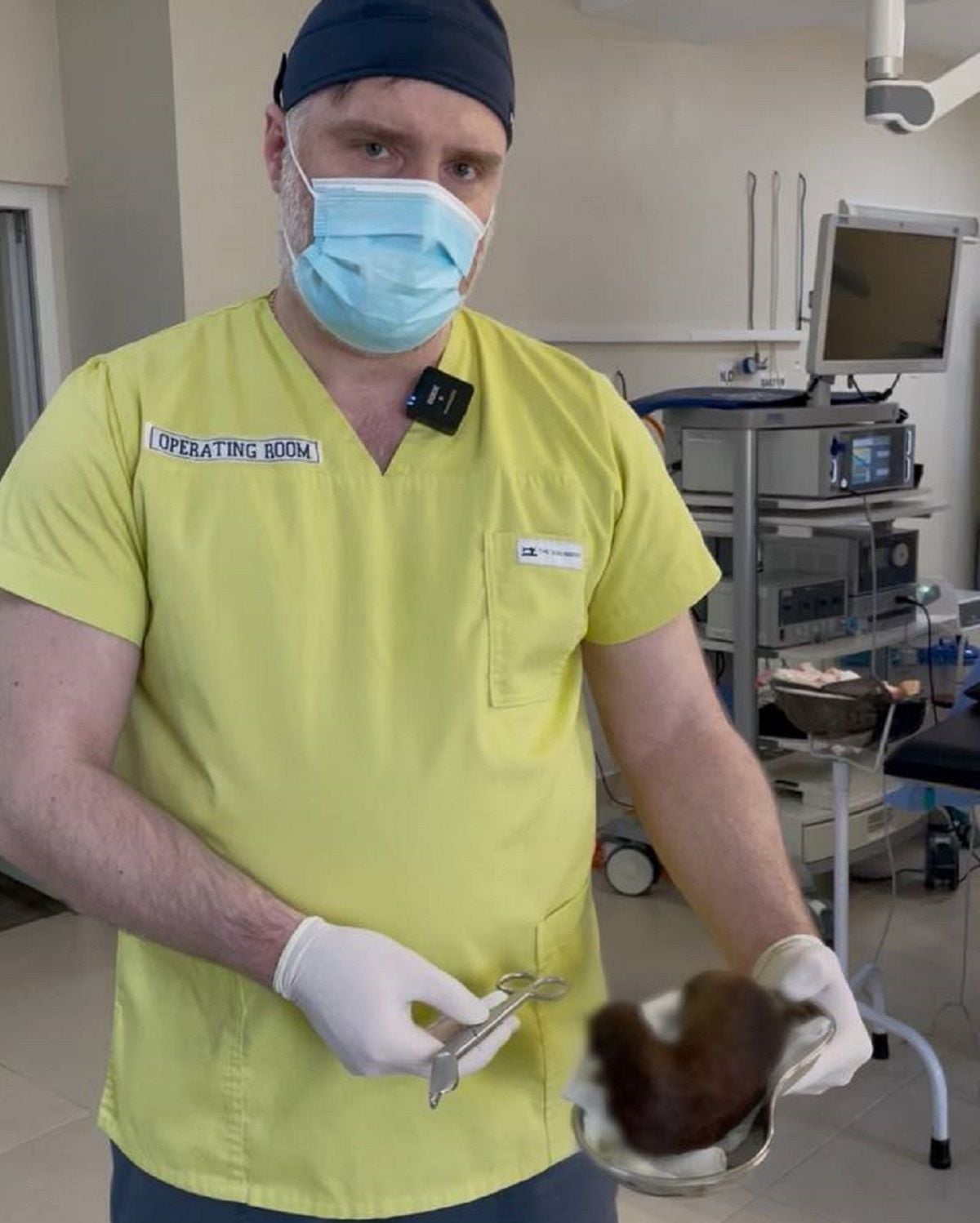 Хірург зі  клубком волосся, яке дістали зі шлунка дитини