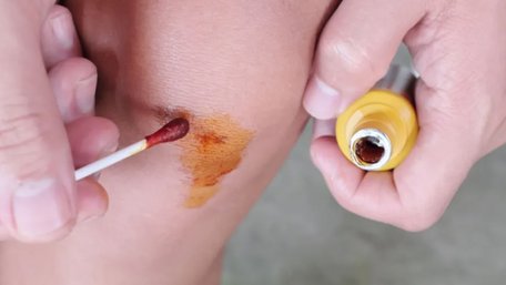 Безпечні і прості варіанти: чим швидко відмити йод зі шкіри та нігтів