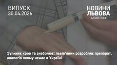 Львів’янин розробляє унікальний для України гель, який зупиняє кров