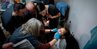 Дітям зі складними вадами обличчя у Львові безкоштовно встановлять титанові імпланти