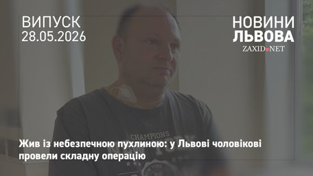 Львівські медики видалили рідкісну судинну пухлину на шиї 50-річного пацієнта