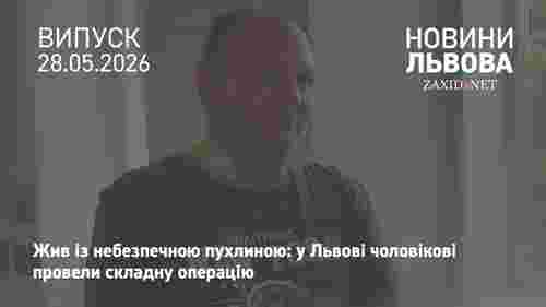 Львівські медики видалили рідкісну судинну пухлину на шиї 50-річного пацієнта