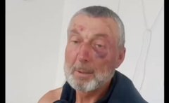 Поліція розслідує побиття 61-річного жителя Сарн після заяви родини про дії ТЦК