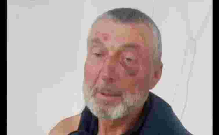 Поліція розслідує побиття 61-річного жителя Сарн після заяви родини про дії ТЦК