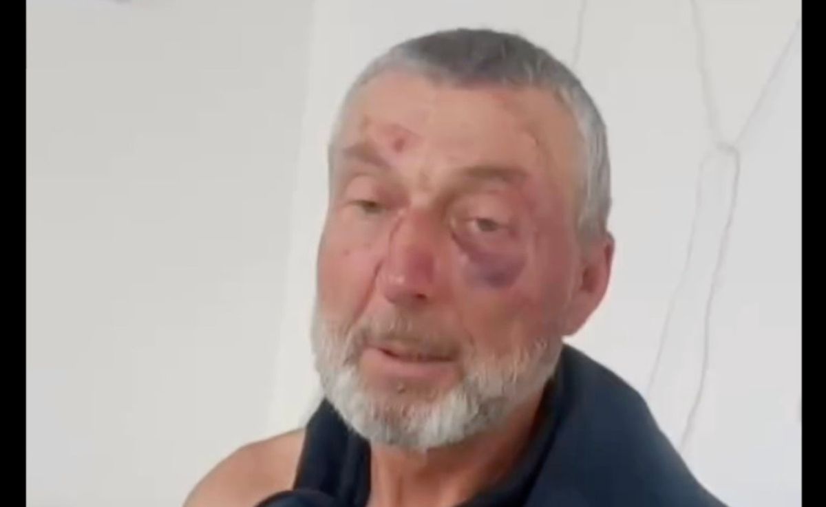 Поліція розслідує побиття 61-річного жителя Сарн після заяви родини про дії ТЦК