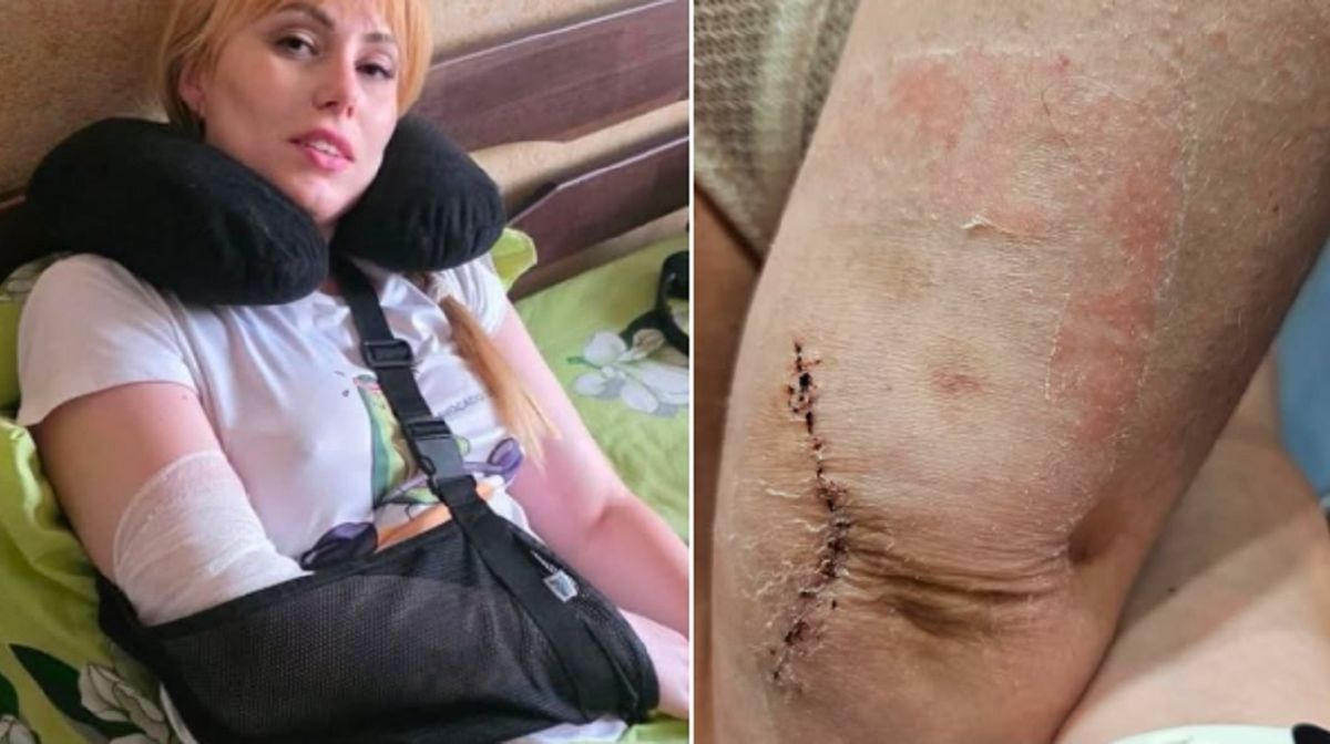 Харківська адвокатка звернулась до ЄСПЛ через побиття в ТЦК
