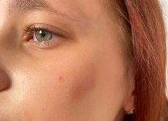 У Польщі на дитячому майданчику побили підлітків за те, що вони розмовляли українською