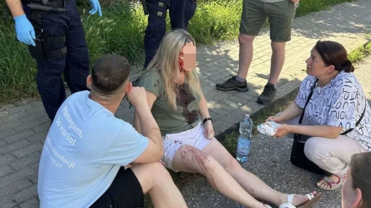 У Польщі невідомий побив 40-річну українку палицею