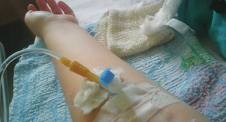 Інфекціоністи Львова врятували 56-річну львів’янку з інфекційним ураженням головного мозку