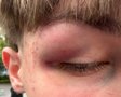 У Львові сталася бійка між 17-річним підлітком та викладачем коледжу